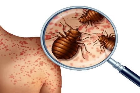 Don't Let the Bed Bugs Bite – How To Avoid This Unwanted Guest In Your Hotel Bed